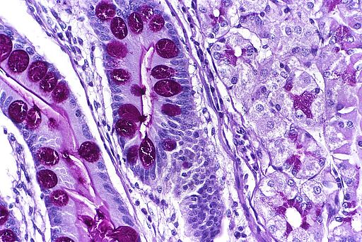 Intestinale Metaplasie (Magen, PAS)